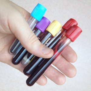 Blood Test for Sick Employees